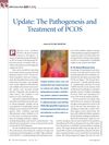 Update: The Pathogenesis and Treatment of PCOS