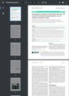 Therapeutic Potential of Hair Follicle-Derived Stem Cell Intranasal Transplantation in a Rat Model of Ischemic Stroke