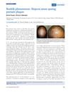 Renbök Phenomenon: Alopecia Areata Sparing Psoriasis Plaques