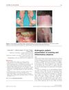 Androgenic pattern presentation of scarring and inflammatory alopecia