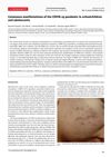 Cutaneous manifestations of the COVID-19 pandemic in schoolchildren and adolescents
