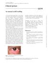 An Unusual Eyelid Swelling