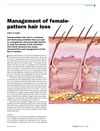 Management of female-pattern hair loss