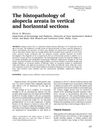 The histopathology of alopecia areata in vertical and horizontal sections
