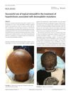 Successful use of topical minoxidil in the treatment of hypotrichosis associated with desmoplakin mutations