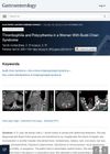 Thrombophilia and Polycythemia in a Woman With Budd-Chiari Syndrome