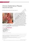 Chronic Erythematous Plaques Around the Ears