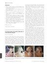 It's Not All Traction: The Pseudo 'Fringe Sign' in Frontal Fibrosing Alopecia