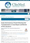 Scalp Arteriovenous Fistula following Hair Transplantation: A Case Report and Review of the Literature