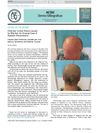 Follicular Lichen Planus Caused by Wig Use: An Unusual Case of Koebner Phenomenon