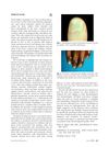 Alopecia Areata: Clinical Presentation, Pathogenesis, and Treatment Options
