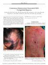 Cutaneous Mastocytosis Associated With Congenital Alopecia