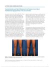 Fractional Resurfacing and Topical Bimatoprost for the Treatment of Laser-Induced Postinflammatory Hypopigmentation on the Lower Extremities
