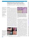 Multibacillary Leprosy with Positive Serology Misdiagnosed as Systemic Lupus Erythematosus