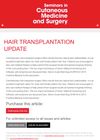 Hair Transplantation Update