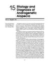 Etiology and diagnosis of androgenetic alopecia