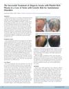 The Successful Treatment of Alopecia Areata with Platelet Rich Plasma in a Case of Twins with Genetic Risk for Autoimmune Disorders