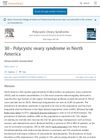 Polycystic ovary syndrome in North America