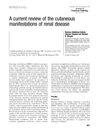 A current review of the cutaneous manifestations of renal disease