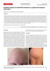 Excellent Response to Tofacitinib Treatment in a Patient with Alopecia Universalis