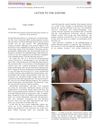 Frontal Fibrosing Alopecia: Regrowth Following Cessation of Sunscreen on the Forehead
