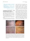 Unusual patterns of presentation of frontal fibrosing alopecia: A clinical and trichoscopic analysis of 98 patients