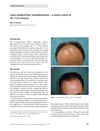 Laser-assisted hair transplantation - a status report in the 21st century