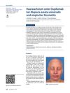 Haarwachstum unter Dupilumab bei Alopecia areata universalis und atopischer Dermatitis