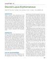 Discoid Lupus Erythematosus