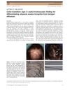 Color-transition sign: A useful trichoscopic finding for differentiating alopecia areata incognita from telogen effluvium