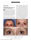 Eyelash Preservation During Chemotherapy and Topical Prostaglandin Therapy