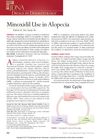 Minoxidil Use in Alopecia