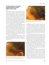 Traction alopecia: 2% topical minoxidil shows promise. Report of two cases