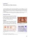 Description of skin lesions