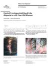 Central Frontoparietal Band-Like Alopecia in a 40-Year-Old Woman