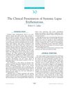 The Clinical Presentation of Systemic Lupus Erythematosus