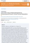 5048 A Rare Cause of Hyperandrogenism in Postmenopausal Women: Ovarian Stromal Hyperplasia