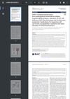 RSPO1-Mutated Keratinocytes From Palmoplantar Keratoderma Display Impaired Differentiation and Invasiveness: Implications for Squamous Cell Carcinoma Susceptibility in Patients With 46XX Disorder of Sexual Development