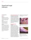 Superficial Fungal Infections