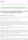 Chronic urticaria versus dermatomyositis in a case of T- cell large granular lymphocytic leukemia