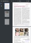 Upadacitinib for management of alopecia areata and rheumatoid arthritis: Letter to the editor