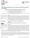 JAK Inhibitor Baricitinib in the Treatment of Oral Lichen Planus: A Case Report