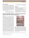 Eyelash trichomegaly: Report of a case following diffuse hair loss associated with transient malnutrition