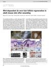 Wnt-dependent de novo hair follicle regeneration in adult mouse skin after wounding