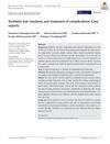Synthetic hair reactions and treatment of complications: Case reports