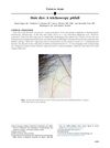 Hair dye: A trichoscopy pitfall