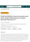 Scalp Psoriasiform Contact Dermatitis with Acute Telogen Effluvium Due to Topical Minoxidil Treatment