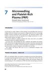 Microneedling and Platelet‐Rich Plasma (PRP)